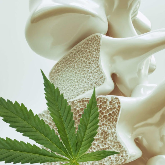CBD for Osteoporosis